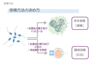 受精方法